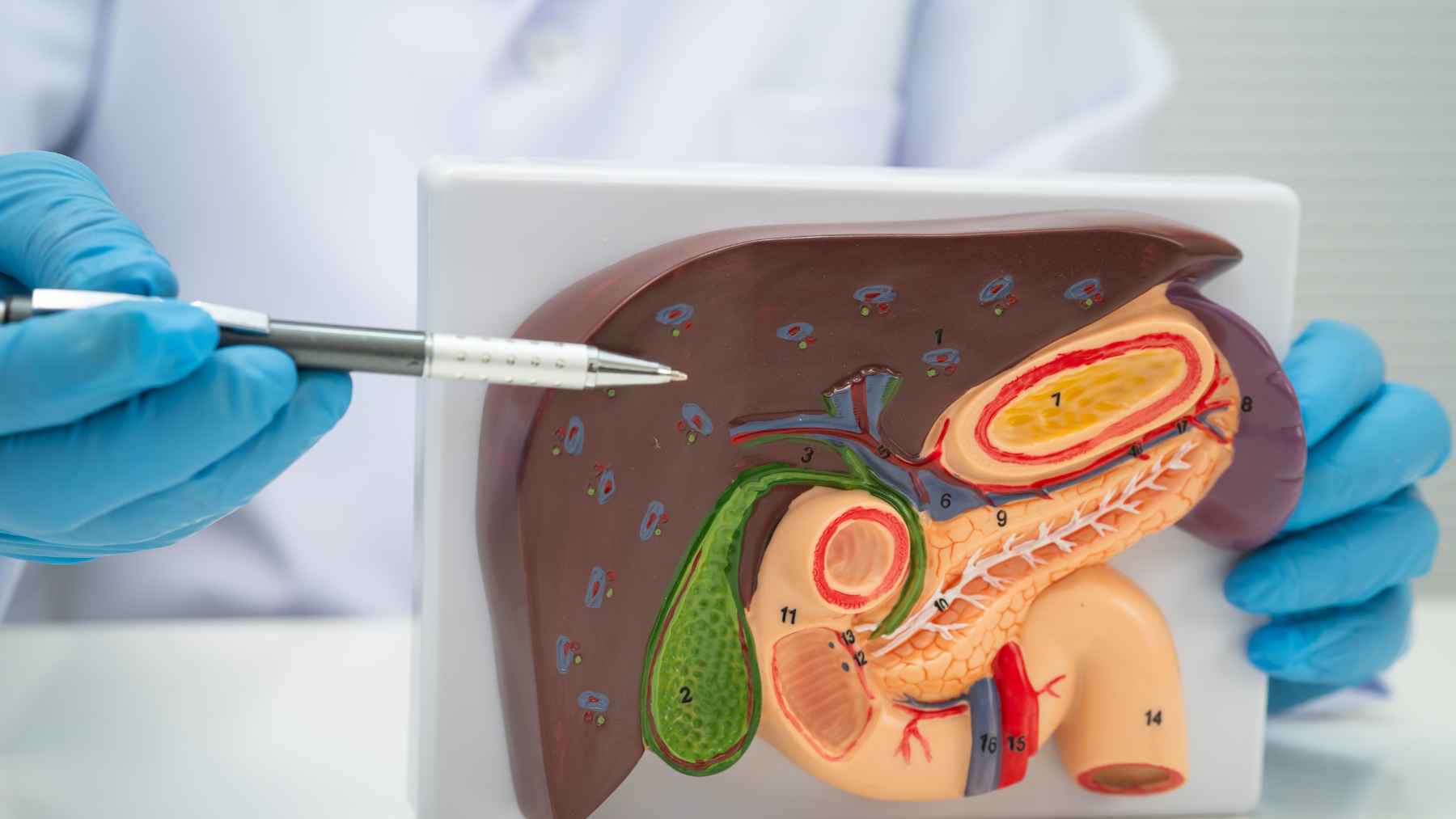 Scientists just found a gut bacterium that floods your liver with ammonia and may quietly drive advanced fatty liver disease 1 A scientific illustration representing the gut-liver axis and bacterial interactions involved in metabolic fatty liver disease and liver scarring.