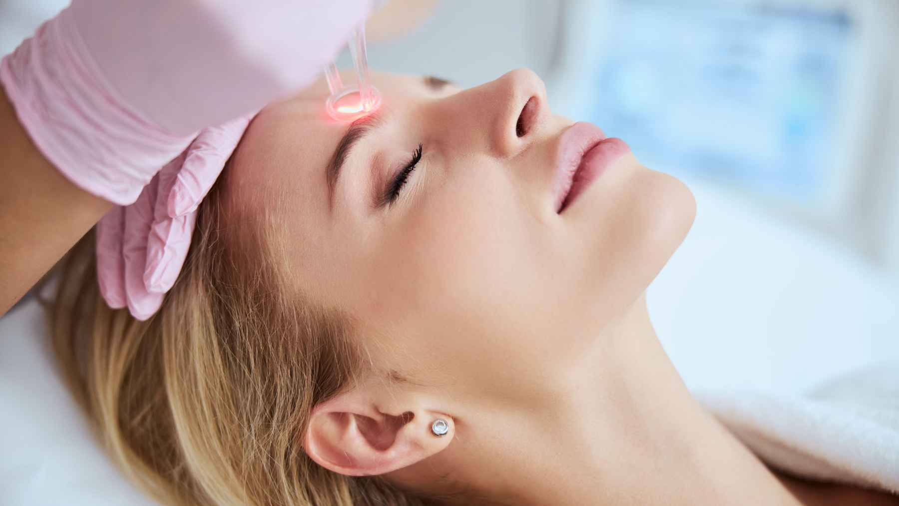 A patient receives a laser facial treatment at a dermatology clinic as a specialist applies a laser device to the forehead.