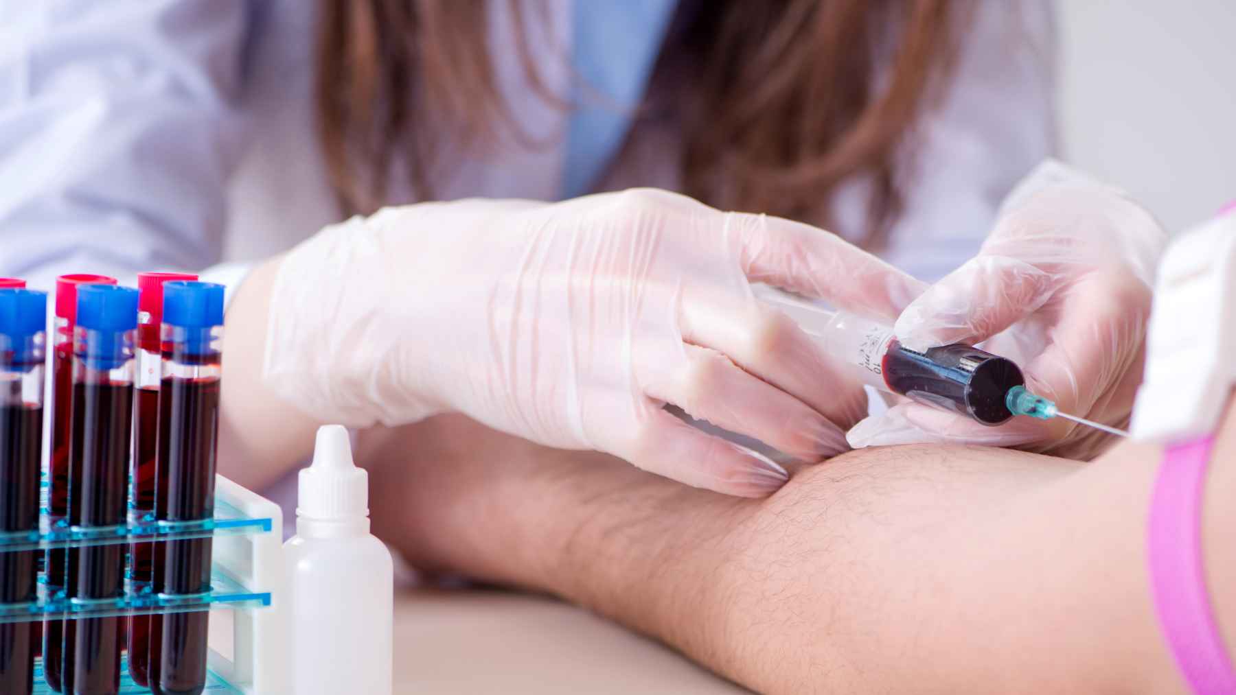 A healthcare professional collects a blood sample for a liquid biopsy that measures circulating tumor DNA to monitor possible cancer recurrence.