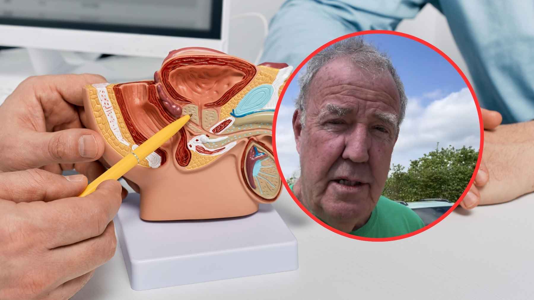 Medical technology equipment used for targeted focal therapy and high-intensity focused ultrasound in prostate cancer treatment.