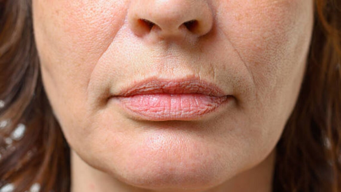 Remedios para las arrugas en los labios a partir de los 50Labios sin codigo de barra después de los 50 años Así puedes conseguirlos