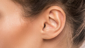 ¿Cómo eliminar las espinillas negras de las orejas?