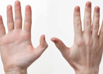 El significado de tener el dedo anular más largo que el índice