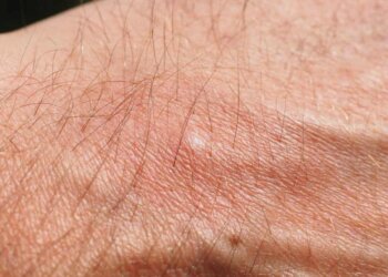 Jamás guardes tu ropa en los cajones de los hoteles: aviso urgente de los expertos