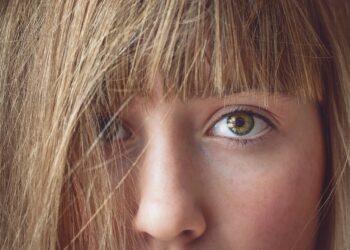 puntos negros de la nariz