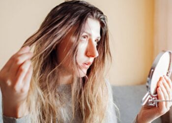 cuero cabelludo graso