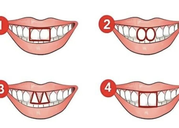 Dientes, test de personalidad, formas de dientes