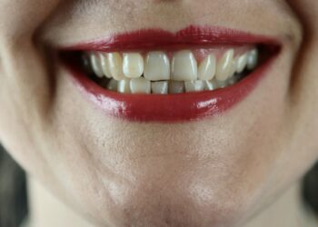 Adiós al bruxismo: los ejercicios clave de una experta que te van a cambiar la vida