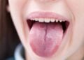 Qué significa tener la lengua blanca, según una dentista experta