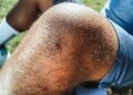 Los científicos identifican el remedio contra el dolor de rodilla: es la estrategia más eficaz para aliviar el dolor y mejorar la movilidad en la osteoartritis