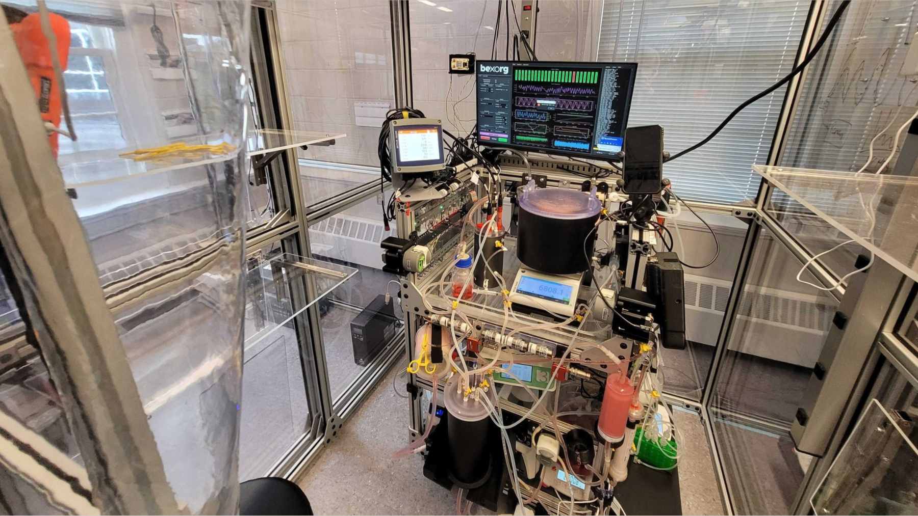 Laboratory equipment and sensors monitoring a postmortem human brain being perfused with an artificial oxygenated solution for drug testing.