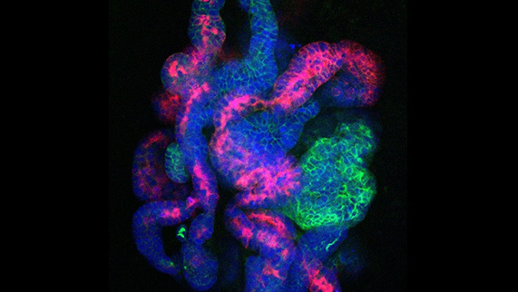 Organoide renal en 3D creado a partir de células madre con estructuras similares a nefronas observado con microscopía fluorescente.