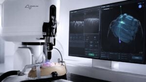 Neuralink construye un robot para colocar implantes cerebrales en pacientes, y la clave es industrializar una cirugía milimétrica donde cada micra importa