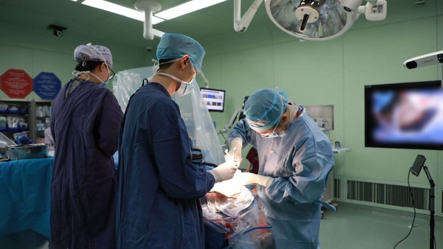 Cirujanos del Hospital Huashan de Shanghái durante la primera implantación comercial del chip cerebral NEO en un paciente con lesión medular.